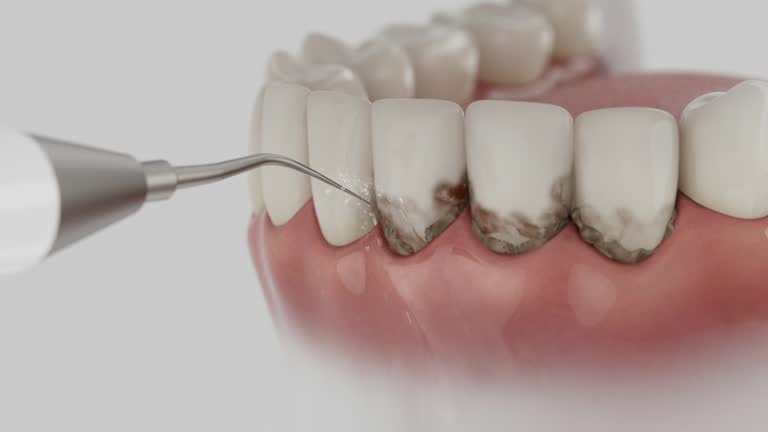 Trusted Dental Implants service in Burlington, NC - Dentist Open Now